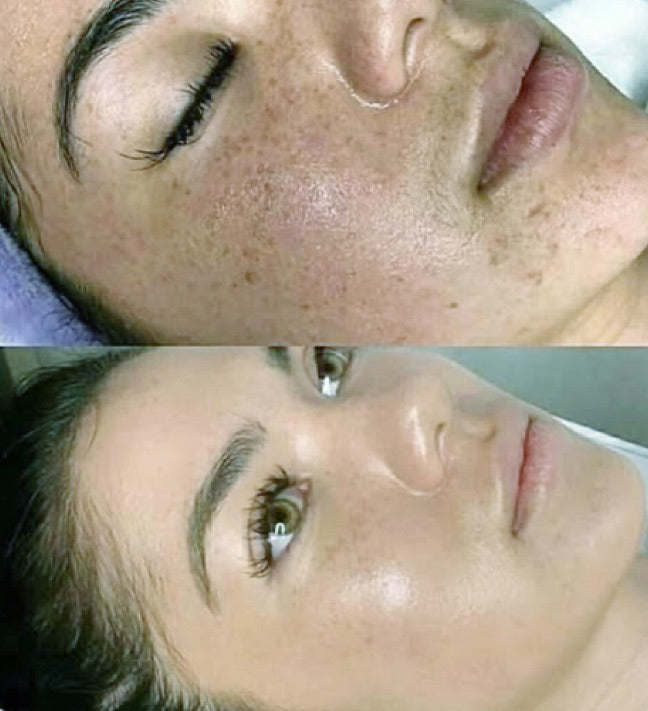 BB Glow: The Semi-Permanent Radiance Treatment